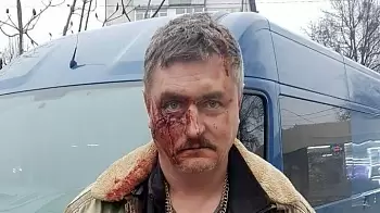 В Житомире отлученный от церкви священник – нудист пристаёт к беременным женщинам (ФОТО)  